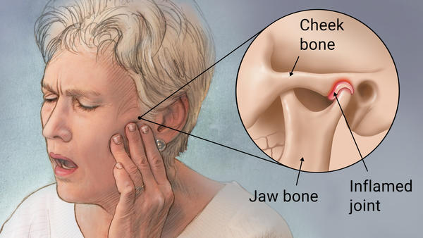 Do You Suffer from TMJ?