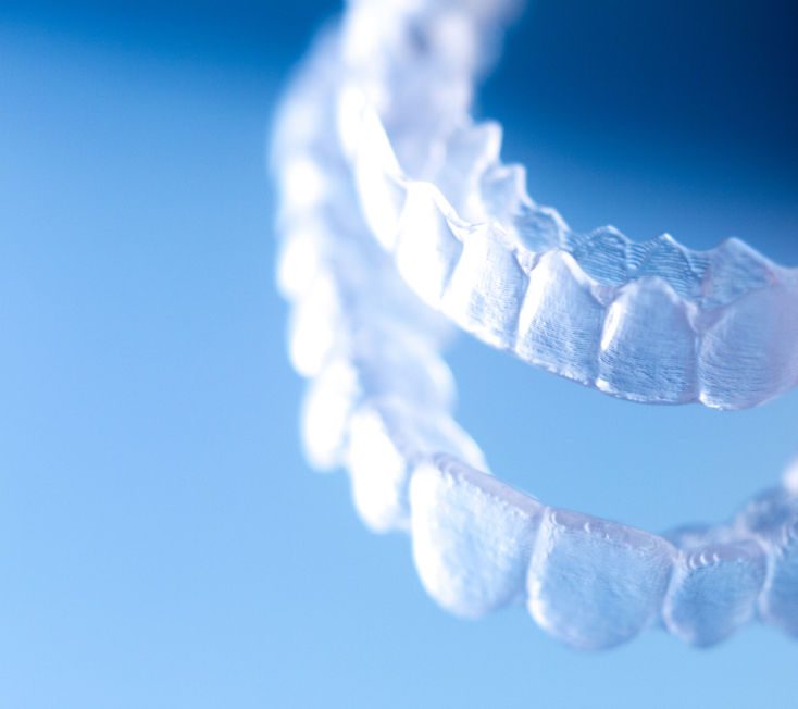 All about Invisalign